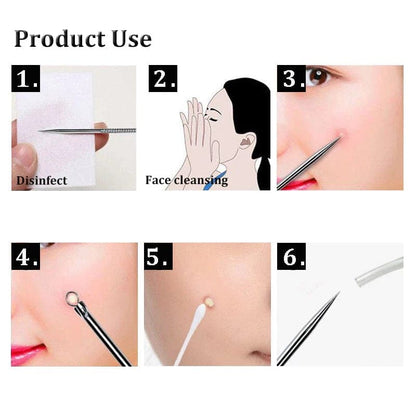 BLACKHEAD REMOVER KIT - Bomstore